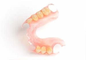 Partial denture example