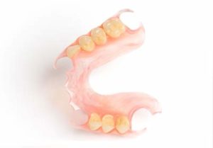 Partial denture example